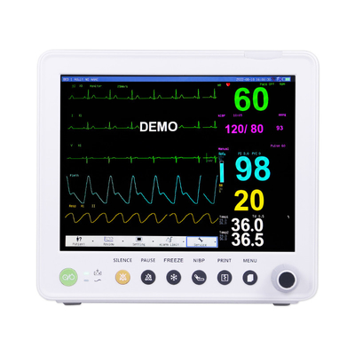 ETCO2 ECG NIBP SPO2 RESP TEMP PR এর প্যারামিটার সহ পোর্টেবল রোগী মনিটর