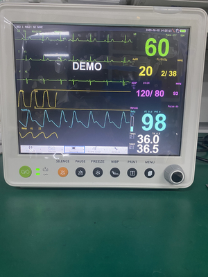 ETCO2 ECG NIBP SPO2 RESP TEMP PR এর প্যারামিটার সহ পোর্টেবল রোগী মনিটর