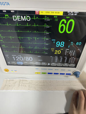 ECG SPO2 NIBP TEMP RESP সহ পোর্টেবল বেডসাইড মনিটর ঐচ্ছিক ETCO2-ক্লাস II 1-বছরের ওয়ারেন্টি